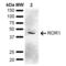 Receptor Tyrosine Kinase Like Orphan Receptor 1 antibody, LS-C774754, Lifespan Biosciences, Western Blot image 