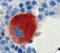 Integrin Subunit Beta 3 antibody, LS-C348388, Lifespan Biosciences, Immunohistochemistry frozen image 