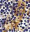 CD209 antigen antibody, PA5-19966, Invitrogen Antibodies, Immunohistochemistry paraffin image 
