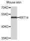 Keratin 14 antibody, STJ24346, St John