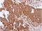 Putative endoplasmin-like protein antibody, NBP2-20700, Novus Biologicals, Immunohistochemistry paraffin image 