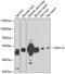 Amylase Alpha 1C (Salivary) antibody, 22-515, ProSci, Western Blot image 