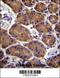 Aspartate Beta-Hydroxylase antibody, 56-642, ProSci, Immunohistochemistry paraffin image 