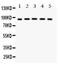 Nuclear Receptor Subfamily 3 Group C Member 1 antibody, LS-C344086, Lifespan Biosciences, Western Blot image 