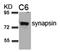 SYN2 antibody, orb14644, Biorbyt, Western Blot image 