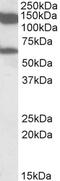 MLLT10 Histone Lysine Methyltransferase DOT1L Cofactor antibody, EB09975, Everest Biotech, Western Blot image 