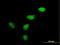 WEE1hu antibody, H00007465-B01P, Novus Biologicals, Immunocytochemistry image 