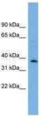 ADP-Ribose/CDP-Alcohol Diphosphatase, Manganese Dependent antibody, TA344799, Origene, Western Blot image 