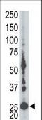 Adenylate Kinase 5 antibody, LS-C101248, Lifespan Biosciences, Western Blot image 