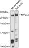Myosin VIIA antibody, 18-378, ProSci, Western Blot image 