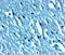 Transient Receptor Potential Cation Channel Subfamily C Member 3 antibody, A01472-3, Boster Biological Technology, Immunohistochemistry frozen image 