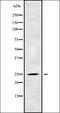 RAB39A, Member RAS Oncogene Family antibody, orb338624, Biorbyt, Western Blot image 
