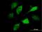 Vav Guanine Nucleotide Exchange Factor 1 antibody, H00007409-M04, Novus Biologicals, Immunofluorescence image 