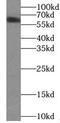 YTH domain family protein 1 antibody, FNab09572, FineTest, Western Blot image 