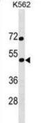 SS18L1 Subunit Of BAF Chromatin Remodeling Complex antibody, abx030087, Abbexa, Western Blot image 