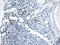 Lymphoid Enhancer Binding Factor 1 antibody, M00605-2, Boster Biological Technology, Immunohistochemistry paraffin image 