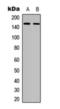 Colony Stimulating Factor 1 Receptor antibody, orb393256, Biorbyt, Western Blot image 