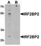 Interferon regulatory factor 2-binding protein 2 antibody, LS-C144482, Lifespan Biosciences, Western Blot image 