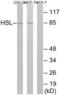 Lipase E, Hormone Sensitive Type antibody, LS-C117614, Lifespan Biosciences, Western Blot image 