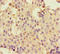 DEAH-Box Helicase 33 antibody, LS-C677667, Lifespan Biosciences, Immunohistochemistry paraffin image 