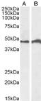 Interferon Regulatory Factor 4 antibody, LS-C154961, Lifespan Biosciences, Western Blot image 