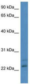 Carbonyl Reductase 4 antibody, TA343017, Origene, Western Blot image 