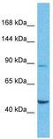 SPT6 Homolog, Histone Chaperone And Transcription Elongation Factor antibody, TA334032, Origene, Western Blot image 