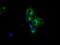 Protein Kinase CAMP-Dependent Type II Regulatory Subunit Alpha antibody, GTX83823, GeneTex, Immunofluorescence image 