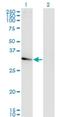 NACAL antibody, H00342538-M01, Novus Biologicals, Western Blot image 