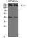 Cytoplasmic FMR1 Interacting Protein 2 antibody, STJ98613, St John