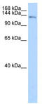 CDKN1A Interacting Zinc Finger Protein 1 antibody, TA343682, Origene, Western Blot image 