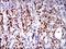 RUNX Family Transcription Factor 3 antibody, GTX60639, GeneTex, Immunohistochemistry paraffin image 