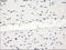Mitogen-Activated Protein Kinase Kinase 1 antibody, LS-C114739, Lifespan Biosciences, Immunohistochemistry frozen image 