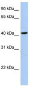 OTU Deubiquitinase With Linear Linkage Specificity Like antibody, TA331077, Origene, Western Blot image 