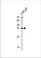 Translationally-controlled tumor protein antibody, TA325038, Origene, Western Blot image 