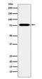 Kinesin Family Member 3A antibody, M03439, Boster Biological Technology, Western Blot image 