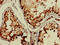 TBC1 Domain Family Member 15 antibody, LS-C672313, Lifespan Biosciences, Immunohistochemistry paraffin image 