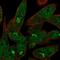 Ubiquitin Specific Peptidase 33 antibody, NBP1-82931, Novus Biologicals, Immunocytochemistry image 