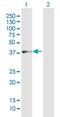 Adenosine Deaminase TRNA Specific 3 antibody, H00113179-B01P, Novus Biologicals, Western Blot image 