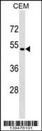 Somatostatin Receptor 5 antibody, 60-259, ProSci, Western Blot image 