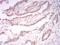 Keratin 5 antibody, NBP2-52443, Novus Biologicals, Immunohistochemistry paraffin image 