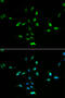 E3 ubiquitin-protein ligase Mdm2 antibody, 13-148, ProSci, Immunofluorescence image 