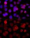 Bromodomain Adjacent To Zinc Finger Domain 1B antibody, GTX64663, GeneTex, Immunofluorescence image 