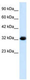 Chromosome 22 Open Reading Frame 31 antibody, TA338066, Origene, Western Blot image 
