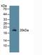 R-Spondin 1 antibody, LS-C296290, Lifespan Biosciences, Western Blot image 