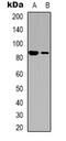 Integrin Subunit Beta 3 antibody, abx133549, Abbexa, Western Blot image 