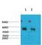 Potassium Voltage-Gated Channel Modifier Subfamily V Member 2 antibody, A08497-1, Boster Biological Technology, Western Blot image 