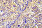 Protein Kinase AMP-Activated Non-Catalytic Subunit Beta 1 antibody, LS-C178073, Lifespan Biosciences, Immunohistochemistry paraffin image 