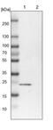 TBC1 Domain Family Member 7 antibody, PA5-57042, Invitrogen Antibodies, Western Blot image 
