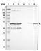 Cytohesin 3 antibody, NBP1-90097, Novus Biologicals, Western Blot image 
